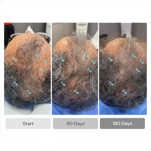 DS Laboratories Spectral.DNC-S Anti-gray + Hair Serum 60ml