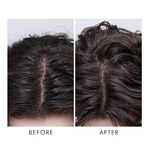 Moroccanoil  Oily Scalp Treatment