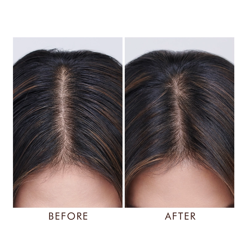 Moroccanoil  Oily Scalp Treatment