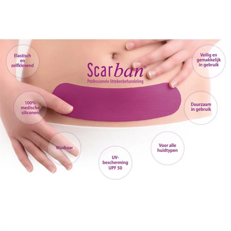 Scarban  Siliconenverband C-Section